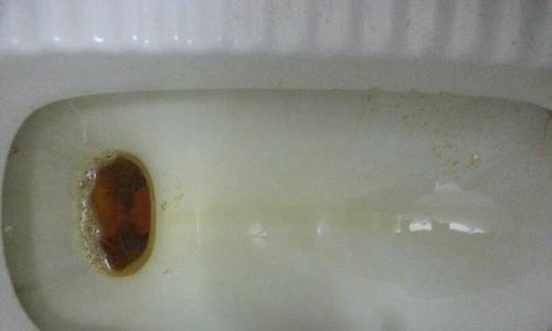 尿液变绿色的原因及其健康含义(探究尿液发绿的可能原因,了解身体健康情况)(图2) 尿液变绿色的原因及其健康含义(探究尿液发绿的可能原因,了解身体健康情况)(图2)