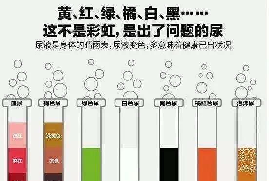 尿液变绿色的原因及其健康含义(探究尿液发绿的可能原因,了解身体健康情况)(图1) 尿液变绿色的原因及其健康含义(探究尿液发绿的可能原因,了解身体健康情况)(图1)