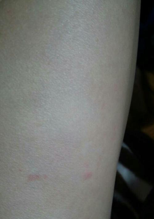 为什么狗狗要咬自己的腿?(探究狗狗咬腿行为的原因和解决方法)(图1) 为什么狗狗要咬自己的腿?(探究狗狗咬腿行为的原因和解决方法)(图1)