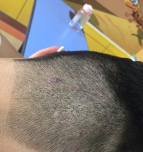 狗狗为何会有头皮屑(头皮屑问题的成因及解决方法)(图3) 狗狗为何会有头皮屑(头皮屑问题的成因及解决方法)(图3)